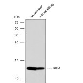 Solarbio K009856P Anti-RIDA Polyclonal Antibody