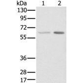 Solarbio K007230P Anti-YY1 Polyclonal Antibody
