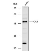 Solarbio K110328P Anti-CA9 Polyclonal Antibody