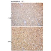 Solarbio K110081P Anti-CYB5R1 Polyclonal Antibody