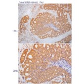 Solarbio K112269P Anti-DDX19B Polyclonal Antibody