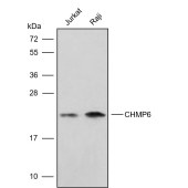 Solarbio K009828P Anti-CHMP6 Polyclonal Antibody