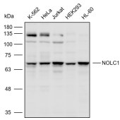 Solarbio K110471P Anti-NOLC1 Polyclonal Antibody