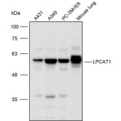 Solarbio K110021P Anti-LPCAT1 Polyclonal Antibody