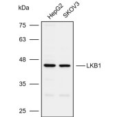 Solarbio K109955P Anti-LKB1 Polyclonal Antibody
