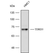 Solarbio K112422P Anti-TDRD3 Polyclonal Antibody