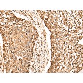 Solarbio K009881P Anti-RBL2 Polyclonal Antibody