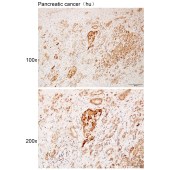 Solarbio K112178P Anti-MET Polyclonal Antibody