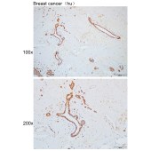 Solarbio K110099P Anti-KPNA6 Polyclonal Antibody