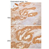 Solarbio K109940P Anti-SERPINA4 Polyclonal Antibody