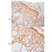 Solarbio K112272P Anti-WBP1 Polyclonal Antibody