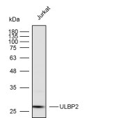 Solarbio K112262P Anti-ULBP2 Polyclonal Antibody