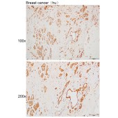 Solarbio K110001P Anti-RAD9A Polyclonal Antibody