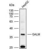 Solarbio K110004P Anti-GALM Polyclonal Antibody