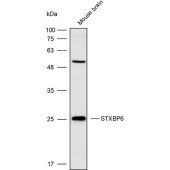 Solarbio K109931P Anti-STXBP6 Polyclonal Antibody