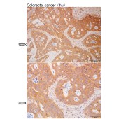Solarbio K112218P Anti-M1AP Polyclonal Antibody