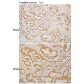 Solarbio K110306P Anti-SEPTIN3 Polyclonal Antibody