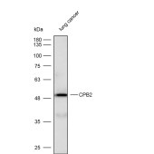 Solarbio K112279P Anti-CPB2 Polyclonal Antibody