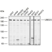 Solarbio K110075P Anti-UBE2O Polyclonal Antibody