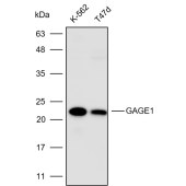 Solarbio K110526P Anti-GAGE1 Polyclonal Antibody