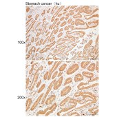 Solarbio K109958P Anti-MKNK1 Polyclonal Antibody