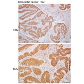 Solarbio K110479P Anti-THUMPD3 Polyclonal Antibody