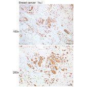 Solarbio K109934P Anti-DNAJB5 Polyclonal Antibody