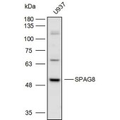 Solarbio K110035P Anti-SPAG8 Polyclonal Antibody