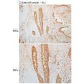 Solarbio K110047P Anti-DNAJC14 Polyclonal Antibody