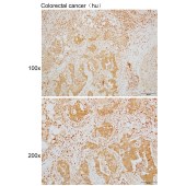 Solarbio K110020P Anti-CHN1 Polyclonal Antibody