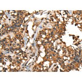 Solarbio K009826P Anti-SHPK Polyclonal Antibody
