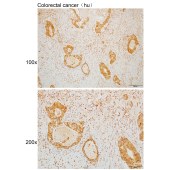 Solarbio K110040P Anti-USP21 Polyclonal Antibody