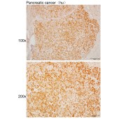 Solarbio K110481P Anti-COG4 Polyclonal Antibody