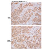 Solarbio K110107P Anti-COX4I1 Polyclonal Antibody
