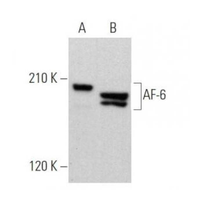 Solarbio K009780M Anti-AF-6（B-5） Monoclonal Antibody - 试剂仪器耗材