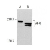 Solarbio K009780M Anti-AF-6（B-5） Monoclonal Antibody