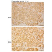 Solarbio K110458P Anti-STK39 Polyclonal Antibody