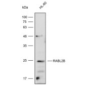 Solarbio K112314P Anti-RABL2B Polyclonal Antibody