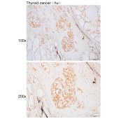 Solarbio K110391P Anti-UFL1 Polyclonal Antibody