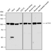 Solarbio K112416P Anti-ACTN2 Polyclonal Antibody