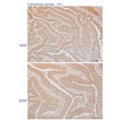 Solarbio K110335P Anti-EIF3G Polyclonal Antibody