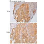 Solarbio K112255P Anti-TNFAIP8 Polyclonal Antibody