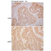 Solarbio K110088P Anti-RNF31 Polyclonal Antibody