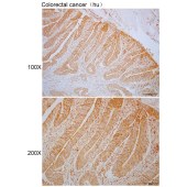 Solarbio K110367P Anti-NCALD Polyclonal Antibody