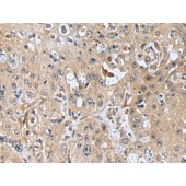 Solarbio K009872P Anti-CORO2B Polyclonal Antibody