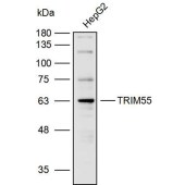 Solarbio K110025P Anti-TRIM55 Polyclonal Antibody