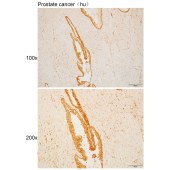 Solarbio K110513P Anti-POLR3K Polyclonal Antibody