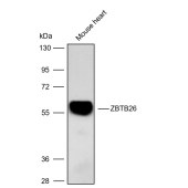 Solarbio K009898P Anti-ZBTB26 Polyclonal Antibody