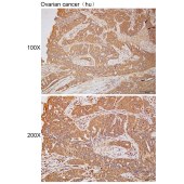 Solarbio K112222P Anti-EFEMP2 Polyclonal Antibody
