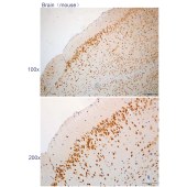 Solarbio K112306P Anti-ANKS1B Polyclonal Antibody
